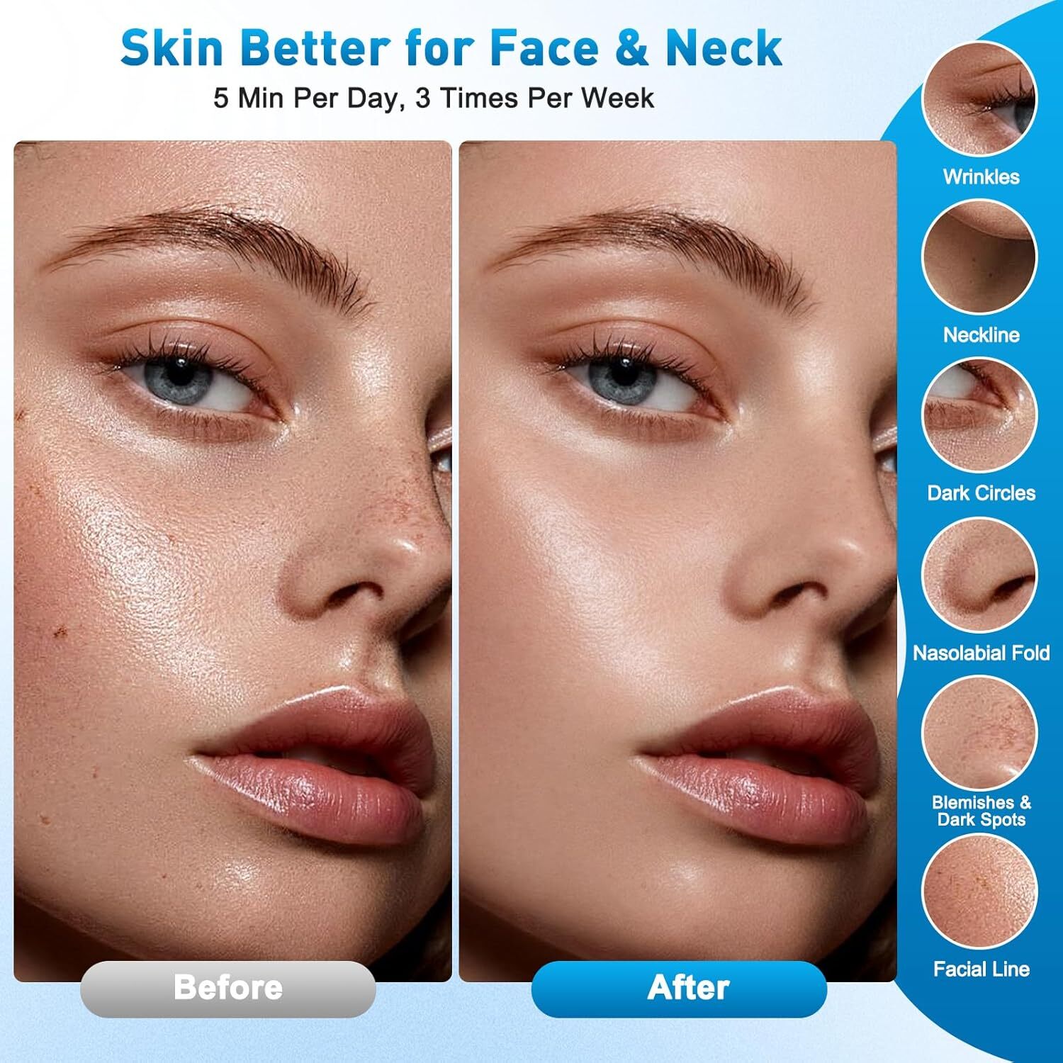  طراحی لوکس و ارگونومیک دستگاه لیفت و جوانسازی صورت 